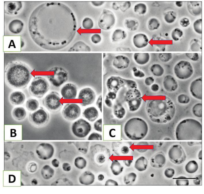 parazit blastocystis hominis)