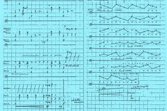 Notasi yang biasa digunakan dalam karya musik kontemporer adalah notasi