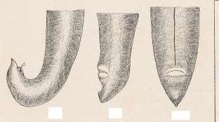 lateral lateral ventral Ujung posterior D. ENTEROBIASIS Enterobius vermicularis (Linnæus, 1758) Leach 1853.
