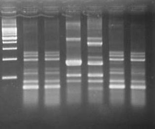 Hasil RAPD-PCR M13 menunjukkan pola pita DNA strain NP29, NP33, NP46, NP57 yang mirip (grup 1), sedangkan isolat NP34 (grup 2) dan NP44 (grup 3) menunjukkan pola pita DNA yang berbeda.