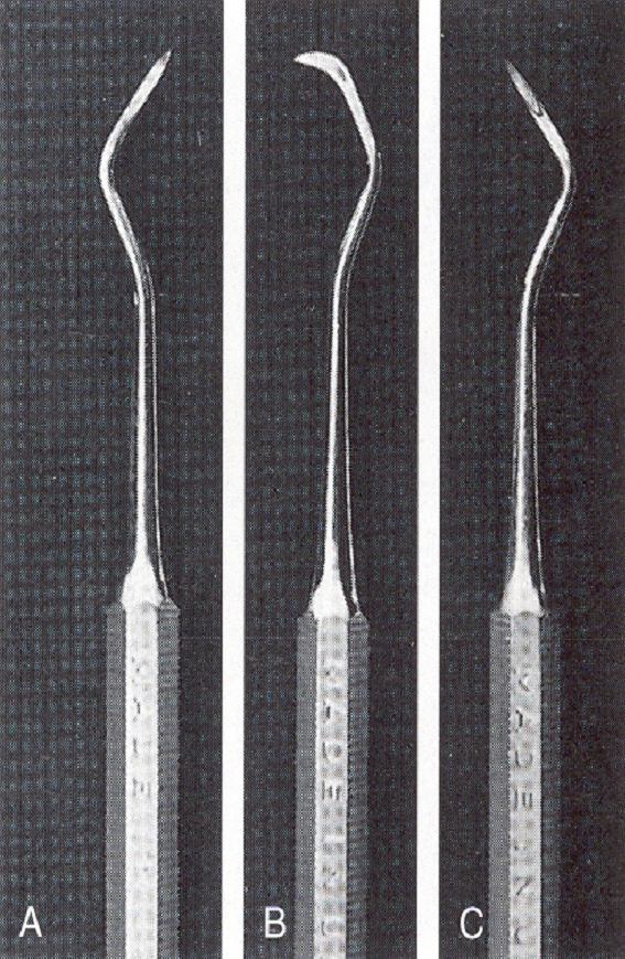 37 Alat periodontal KURET Gambar 7. Kiri: Skeler U15/30; Kanan: Skeler Jacquette. Kuret dibedakan atas dua tipe: kuret universal dan kuret khusus (area-specific/gracey curette).