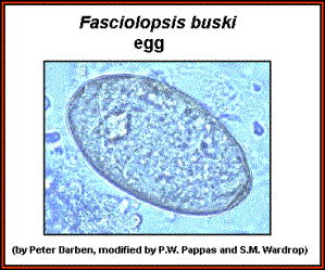 80 Gambar Telur Cacing Fasciolopsis Buski Paling Bagus