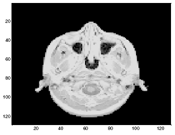 (a). Citra MRI Asli Gambar 1. (b).
