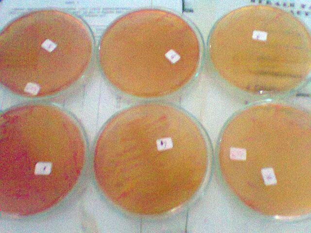 Gambar Lampiran 9. Hasil analisis pemeriksaan Salmonella sp. yang menunjukkan tidak adanya bakteri Salmonella sp.