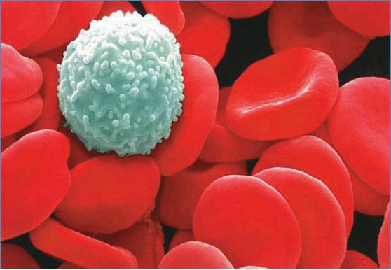 Darah Tersusun dari plasma darah, eritrosit,leukosit dan trombosit Warna merah pada darah karena adanya
