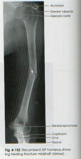 radiografie humerus retabolil și dureri articulare