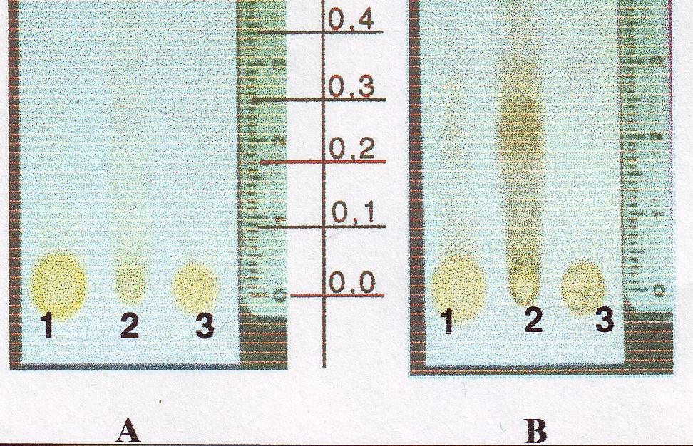 Kromatogram Ekstrak metanol(1), fraksi larut etil asetat (2), dan fraksi tidak arut etil asetat(3) kayu sanrego Tabel 1.