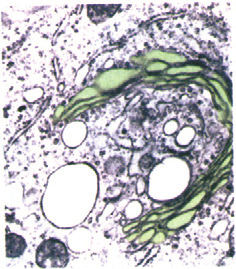 Nukleus Membran sel Pori-pori nukleus Protein dikeluarkan Retikulum endoplasma kasar Vesikula sekresi Vesikel sekresi Vesikel transpor Vesikel transpor Vesikel Sumber: Biology, Raven dan Johnson