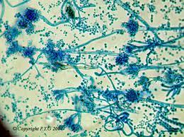 Mikroba osmotoleran: hidup pada aw terendah(0,6) seperti: khamir Saccharomyces rouxii.