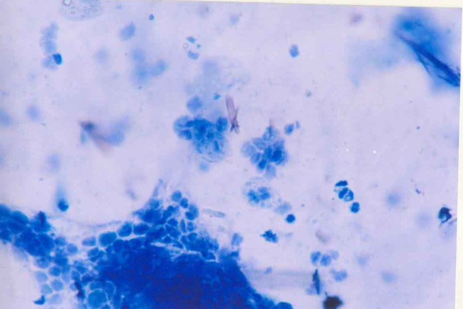 2 Gambar 4.4. Irisan melintang epidermis bagian bawah daun saga (Abrus precatorius L.) dalam media air dengan pembesaran 0 x 5 Keterangan:.