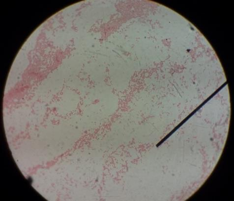 Menurut Lay (1994), genus Bacillus merupakan bakteri Gram positif, berbentuk batang, dan memiliki spora.