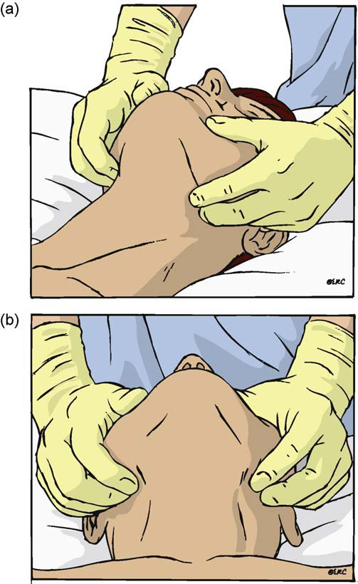 Ekstensikan kepala pasien sejauh mungkin dengan menggunakan satu tangan (Alkatri, 2007). b.