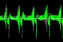 Hasil pengukuran ECG dengan penguatan (a) 70 kali (b) 1000 kali Pada gambar 9 terlihat bahwa hasil sinyal yang menggunakan penguatan 70 kali lebih baik jika dibandingkan dengan penguatan 1000 kali.