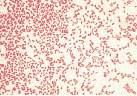 menyebar. Secara mikroskopis bakteri ini memiliki morfologi bentuk seperti koma, berwarna merah saat diamati dibawah mikroskop sehingga merupakan bakteri gram negatif.