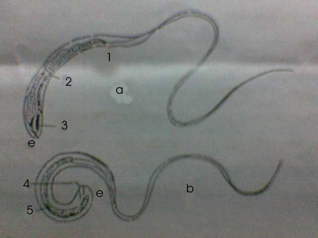 pada batas bagian tubuh anterior dan posterior (tetapi masih terletak bagian tebal). (Soedarti 1991, Soejoto dan Soebari, 1996). Gambar 2 : morfologi cacing dewasa T.trichiura ; a. Cacing betina.