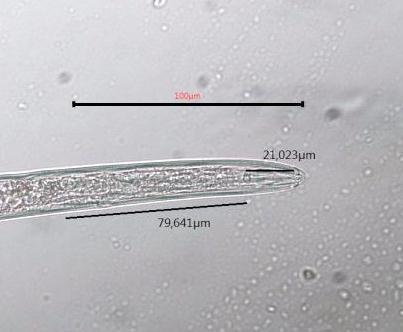 paraziták gisaengchung karóra férgek és koleretikus szer