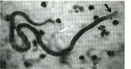 Siklus hidup tersebut di atas terulang kembali ketika mikrofilaria dalam darah manusia terhisap lagi oleh nyamuk. 11 Gambar 3.