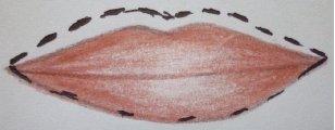 Koreksi Bibir Menurun (Sketsa: Desi Purwaningsih, 2012) Ciri bibir ini adalah bibir bagian atas lebih tebal dari pada bagian bawah sehingga memberi kesan kurang ceria.