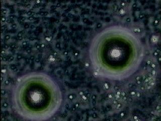Wahidah (2010) menyatakan bahwa stadium uninukleat awal - tengah memiliki ciri-ciri mikrospora berbentuk bulat dengan vakuola yang kecil dan pada stadium uninukleat