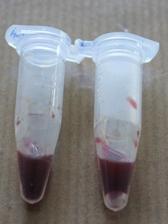 Leukosit Sampel darah