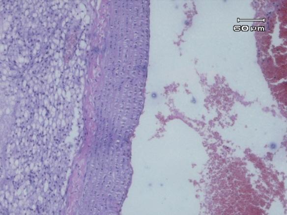 Gambaran mikroskopik aorta kelompok pemberian lemak babi bersamaan dengan daun gedi selama 28 hari.
