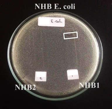 coli NHB1 + - + NHB2 - - - NHB3 + - - NHB4 + - - NHB5 - - - NHC1 + + - NHC2 - + - NHC3 + + - NHC4 - - - NHC5 - - - Keterangan tabel: + : terdapat aktivitas dan : tidak terdapat aktivitas