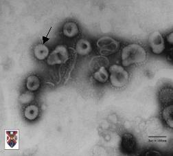 Virus baru : Coronavirus dan Penyakit SARS 23 Apr 2003 Kasus sindrom pernapasan akut parah, atau lebih dikenal dengan SARS (Severe Acute Respiratory Syndrome) masih menempatkan berita utama di