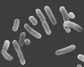 Sebelum ilmuwan dapat menggunakan mikroorganisme untuk keperluan fermentasi atau proses bioteknologi lainnya, mereka harus dapat menumbuhkan kultur murni yang tidak terkontaminasi oleh mikroorganisme