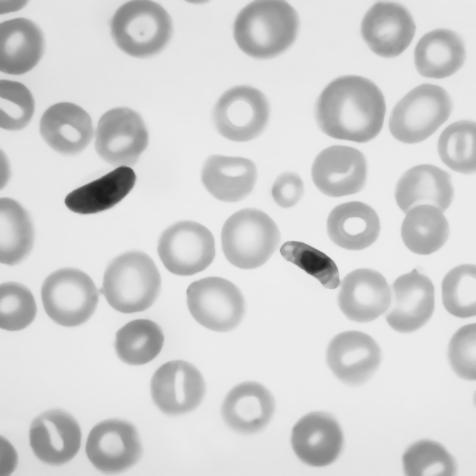 dari data gambar sampel darah, berapa jumlah parasit yang terdapat pada data gambar sampel darah, dan berapa jumlah sel darah yang normal.