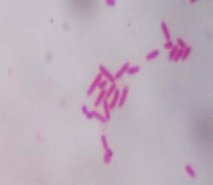 12. Bakteri Citrobacter