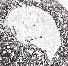Слика 1: Цртежи показују сличност пијавице (Б) и људског ембриона