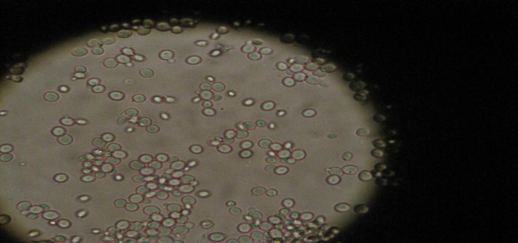 Sel Bakteri (kokus) berasal dari air kran