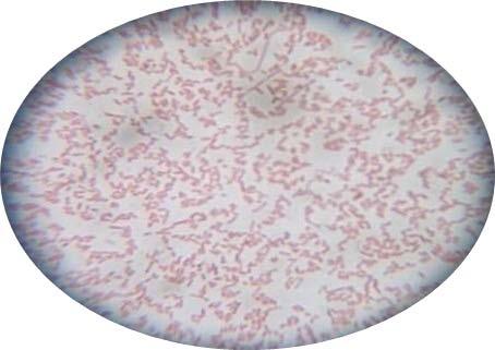 aureus dan Gram negatif bakteri Escherichia coli A B