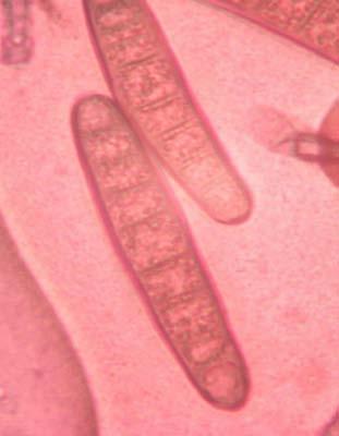 jamur helminthosporium sp hogyan kell kezelni a giardiasis felnőtteknél