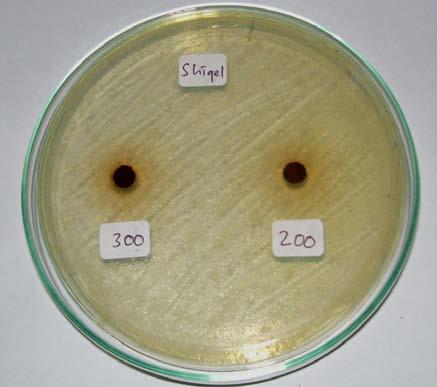 Hasil Uji Aktivitas Antibakteri Ekstrak Kulit Buah Jengkol terhadap Bakteri