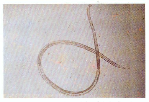 19 c. Morfologi Cacing jantan memiliki panjang ± 1 mm, dengan ekor melingkar dengan spikulum, dan esofagus pendek dengan dua bulbus.