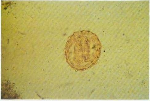 Telur yang dibuahi berukuran ± 60x45 mikron, berbentuk oval, berdinding tebal dengan tiga lapisan dan berisi embrio.