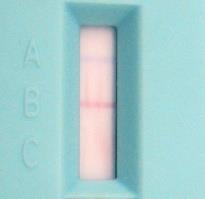Metode pemeriksaan darah pada anak sekolah menggunakan Brugia Rapid TM test Protocol karena di wilayah Kabupaten Agam, jenis mikrofilaria yang ditemukan adalah Brugia malayi.