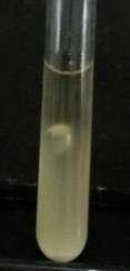 25 dengan adanya gelembung gas di dalam tabung Durham (Gambar 8a), sementara pada bakteri asam laktat yang bersifat homofermentatif tidak ada gelembung gas pada tabung Durham (Gambar 8b).