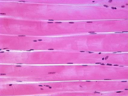 Berbentuk jika sel dilihat lurik dengan mikroskop otot Otot Lurik