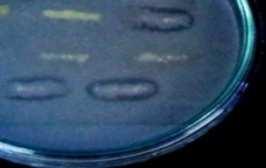 Penapisan Bakteri Penghasil Senyawa Antifungi Hasil penapisan bakteri yang dapat menghambat pertumbuhan Candida albicans yaitu bakteri endofit (HAL 87, Iso act 6,