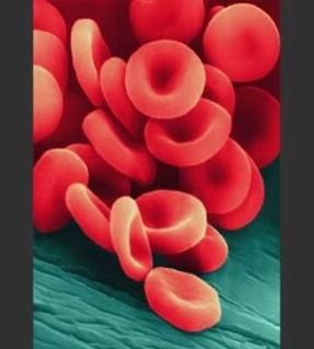 b Eritrosit Sel darah merah merupakan cairan bikonkaf dengan diameter sekitar 7 mikron.