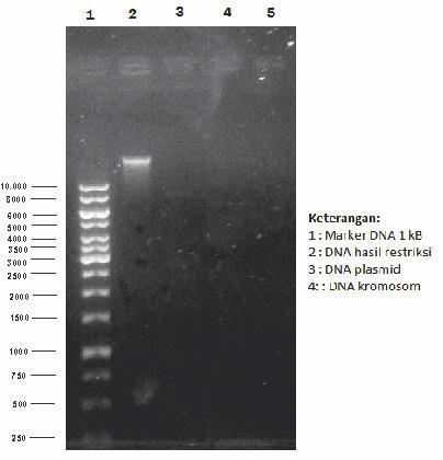 fragmen yang dihasilkan oleh setiap endonuklease restriksi (enzim restriksi) yang digunakan dengan metode elektroforesis gel agarosa.
