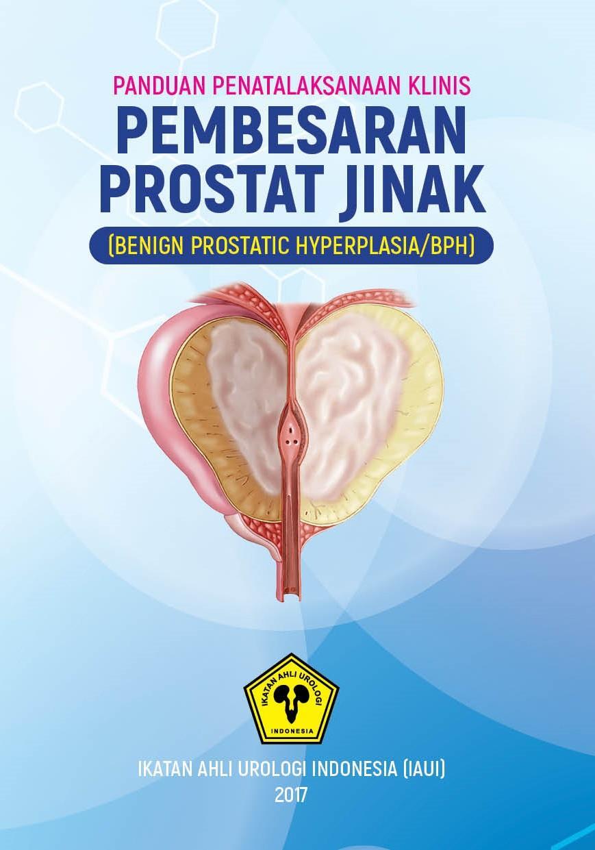 prostatitis a louise széna