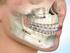 Kebutuhan perawatan ortodonsi berdasarkan index of orthodontic treatment need pada siswa usia tahun di SMP Negeri 1 Wori