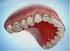 Pergerakan Gigi Dalam Bidang Ortodonsia Dengan Alat Cekat
