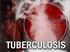 I. PENDAHULUAN. Mycobacterium tuberculosis. Menurut World Health Organization (WHO)