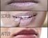 Perbandingan Dua Citra Bibir Manusia Menggunakan Metode Pengukuran Lebar, Tebal dan Sudut Bibir ABSTRAK