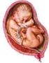 BAB 1 PENDAHULUAN. Plasenta previa adalah plasenta yang menutupi ostium uteri internum baik