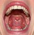 Rongga Mulut. rongga-mulut